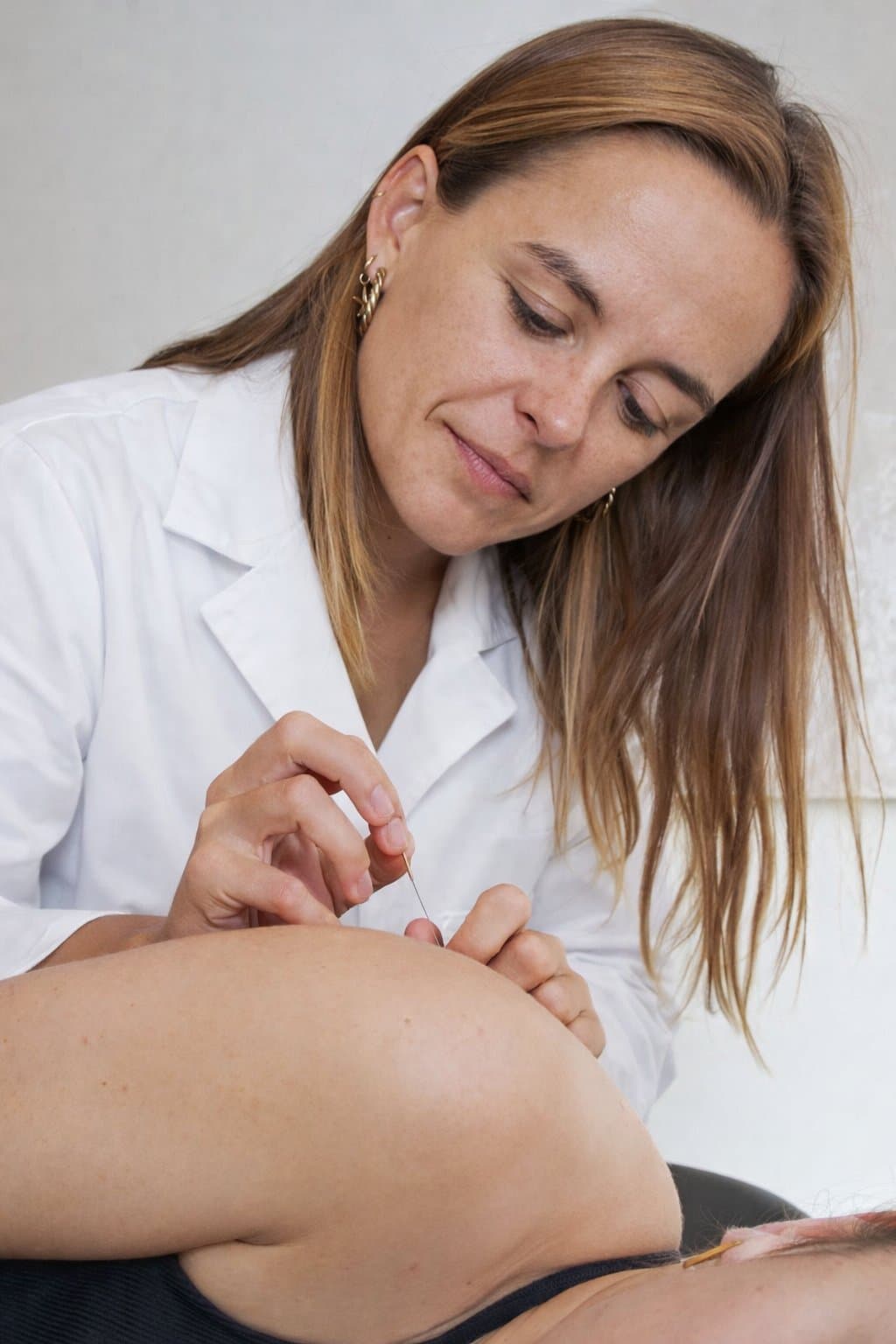 Dry needling behandeling bij Osteozuid Antwerpen